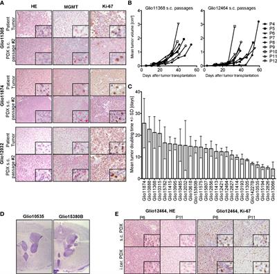 Clinically relevant glioblastoma patient-derived xenograft models to guide drug development and identify molecular signatures